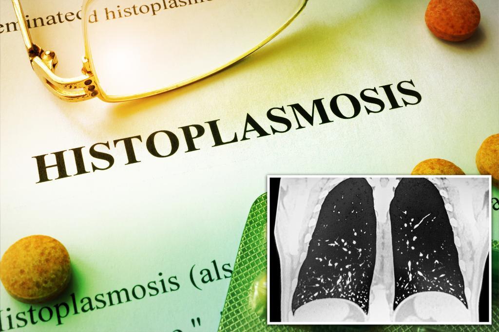 Potentially deadly fungus leaves dozens sickened as infection spreads...